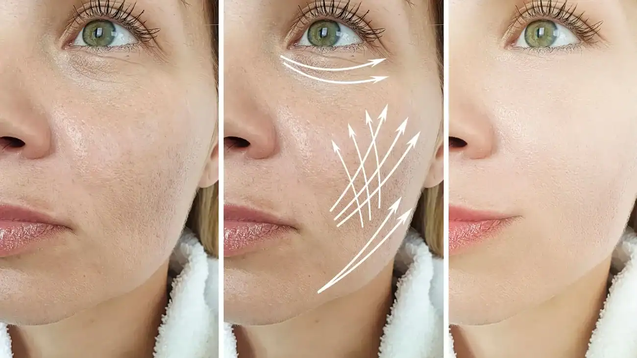 Can One Treatment Really Tackle More Than One Skin Concern Ruislip?