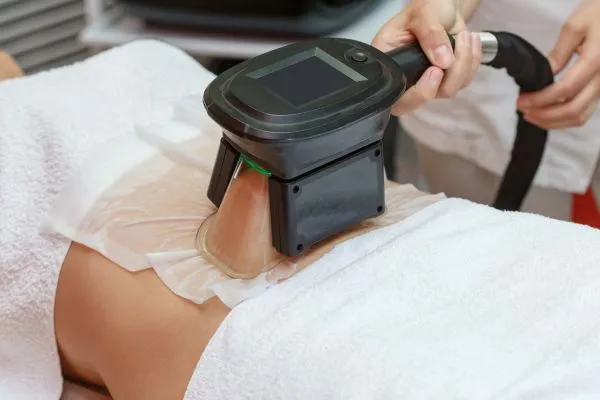 Image of person having fat freezing treatment to help weight gain Ruislip