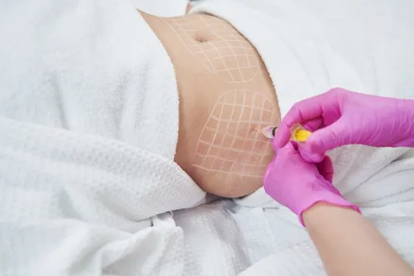image of fat dissolving injections on love handles to help combat weight gain Ruislip