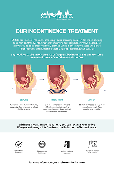 image of how urge incontinence Ruislip treatment works