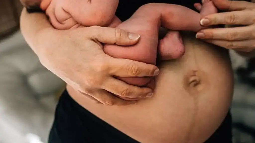 Why Is My Stomach Still Big After Pregnancy Ruislip?